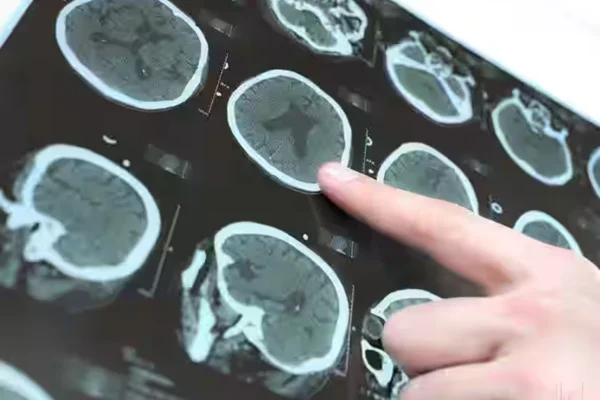 Image of: Providence Neuro Clinic in Palayamkottai Tirunelveli