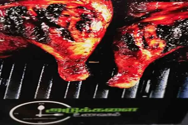 Image of: Adukkala Restaurant - Delicious Traditional Meals for Family Dining