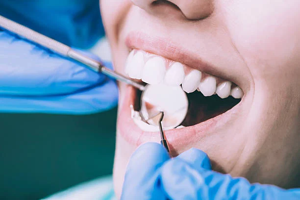 Image of: Srinivasa Dental Care in Ellis Nagar