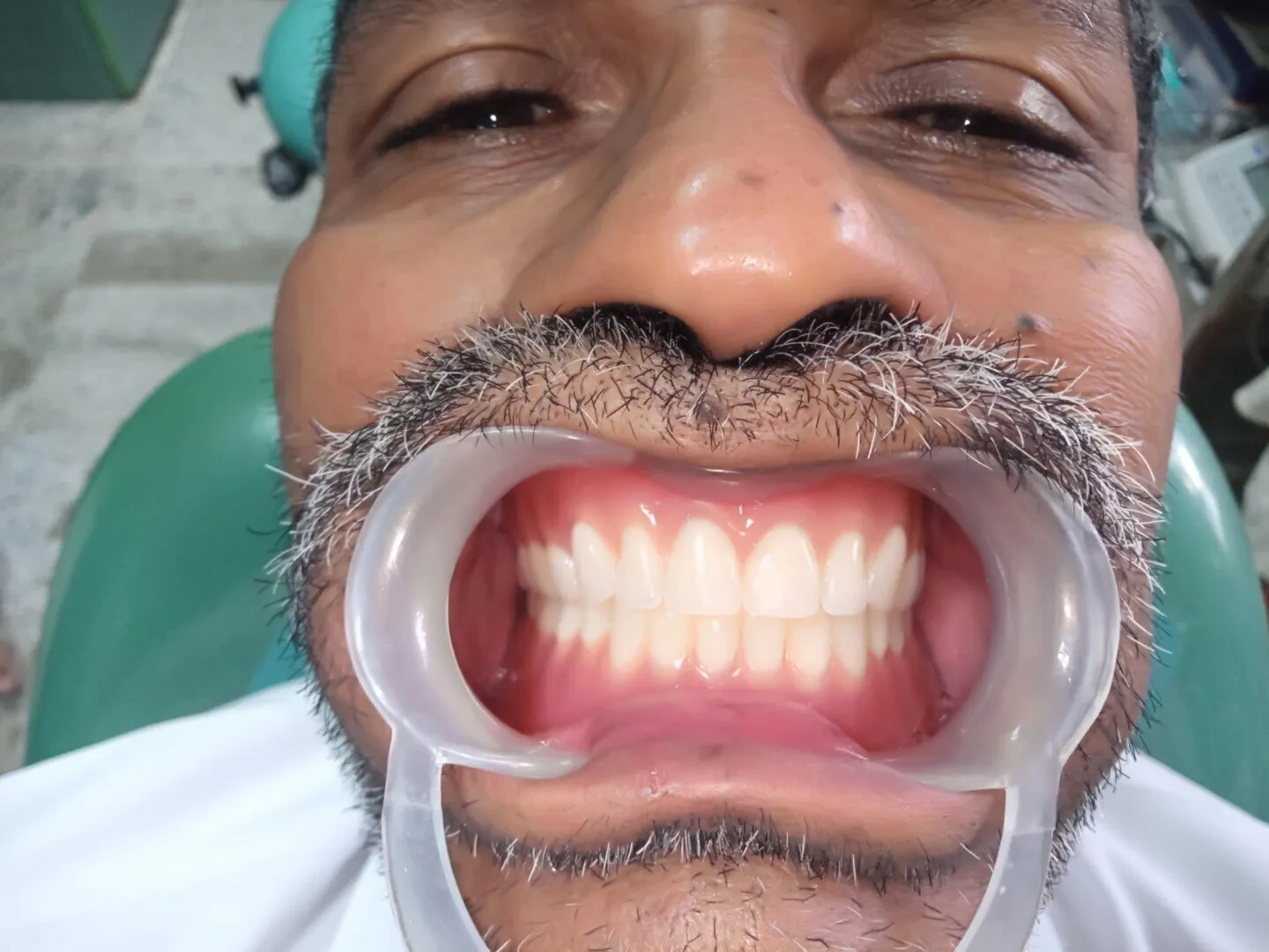 Image of: Kesavan Dental Clinic in K Pudur Madurai