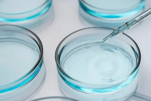 Image of: Top Microbiology Lab Services for Accurate Testing