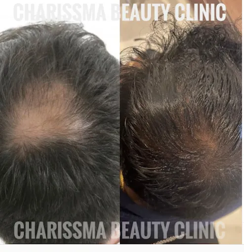 Image of: Charissma Aesthetic Clinic Aesthetic Clinic In T Nagar
