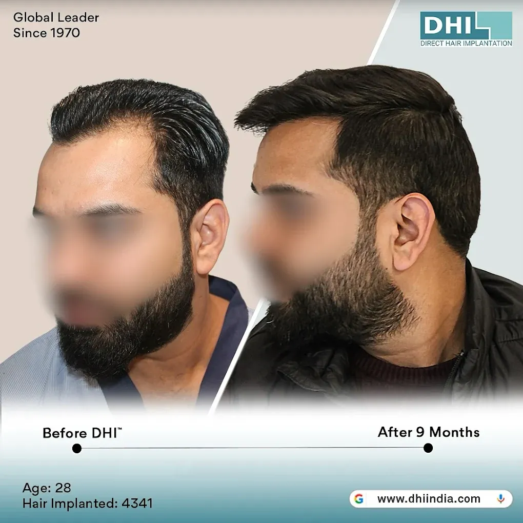 Image of: Dhi India In T Nagar 3