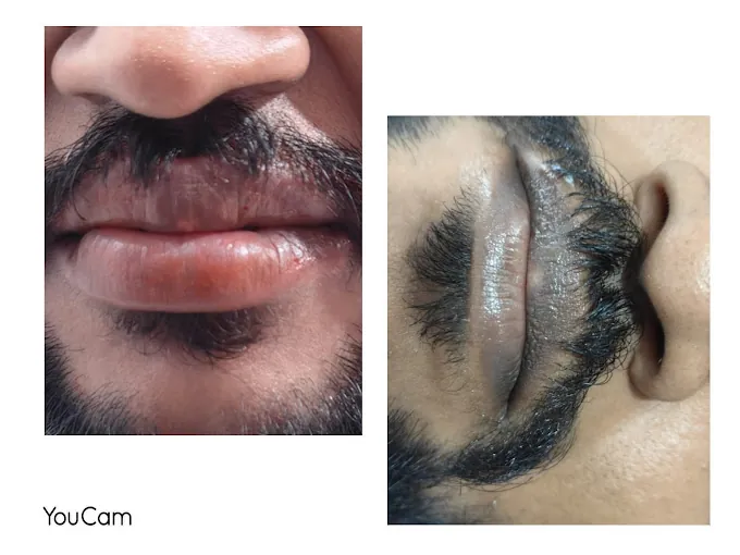 Image of: Forme Unisex Salon And Aesthetics In Mylapore 3