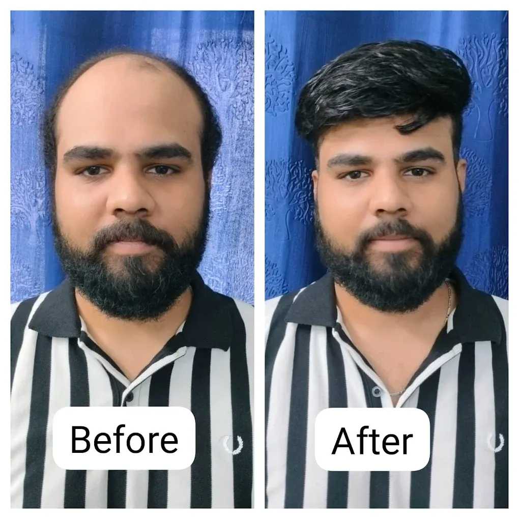 Image of: Gethair Wigs Non Surgical Hair In Saligramam 5