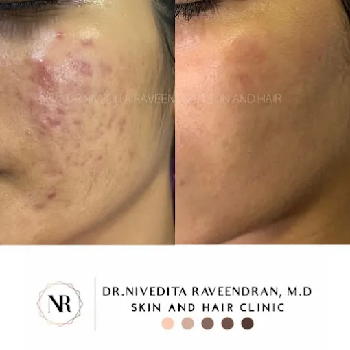 Image of: Rj Aesthetics In Adyar