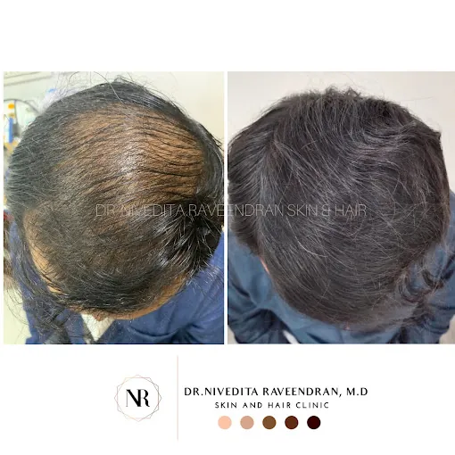 Image of: Rj Aesthetics In Adyar