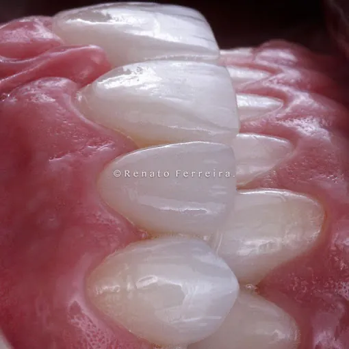 Image of: Aathitya Dental Clinic In T Nagar 2