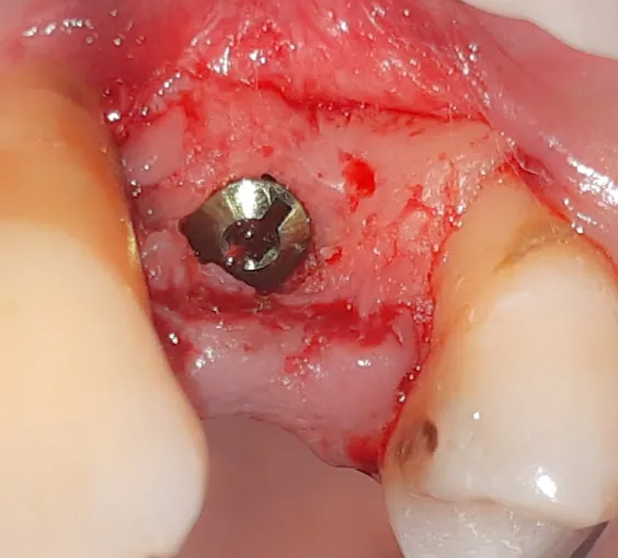 Image of: Aathitya Dental Clinic In T Nagar 3