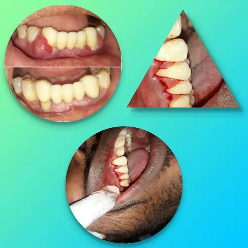 Image of: Aathitya Dental Clinic In T Nagar