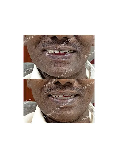 Image of: Abubucker Dental Care And Orthodontic In Triplicane