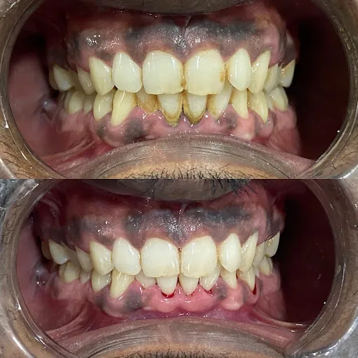 Image of: Am Smiles Dental Clinic In Chennai