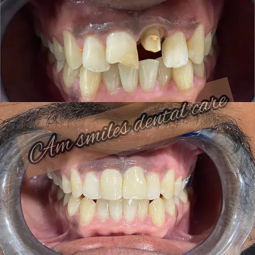 Image of: Am Smiles Dental Clinic In Chennai 3
