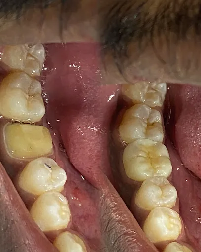 Image of: Am Smiles Dental Clinic In Chennai