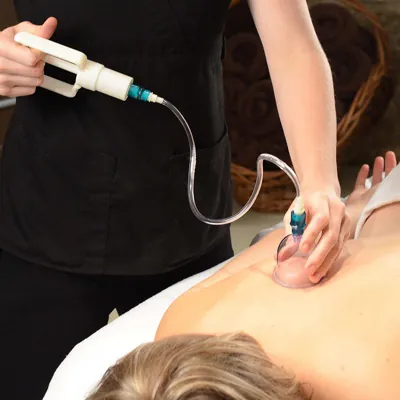 Image of: An Noor Varma Acupuncture Hijama In Perambur