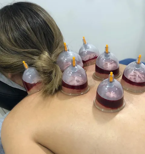 Image of: An Noor Varma Acupuncture Hijama In Perambur