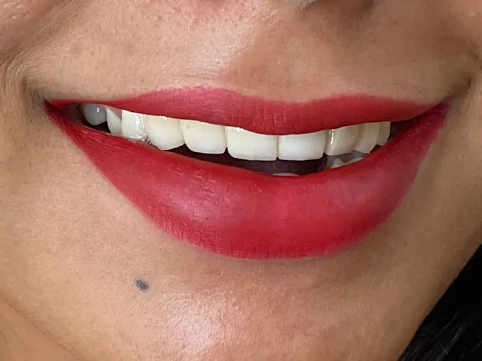 Image of: Asian Laser Dental Clinic In Choolai