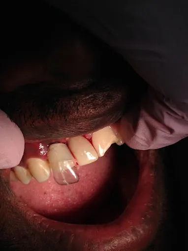 Image of: Best Dental Clinic In T Nagar