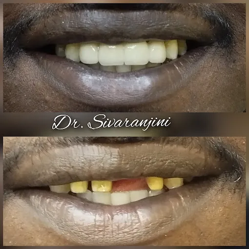 Image of: Bhuvana Dental Clinic In Chennai