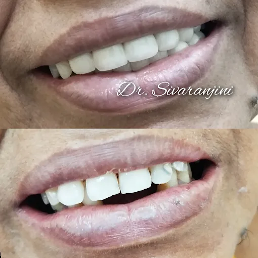 Image of: Bhuvana Dental Clinic In Chennai 2