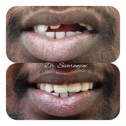 Image of: Bhuvana Dental Clinic In Chennai 3