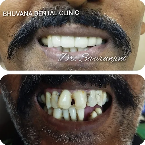 Image of: Bhuvana Dental Clinic In Chennai