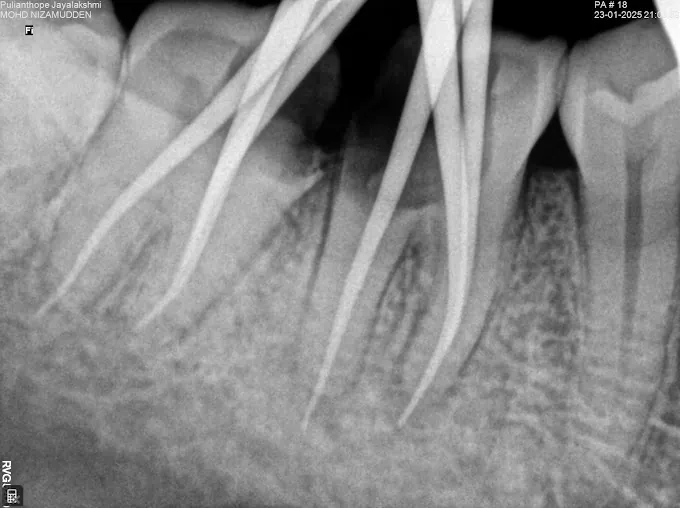 Image of: Bright Dental Care In Egmore 2