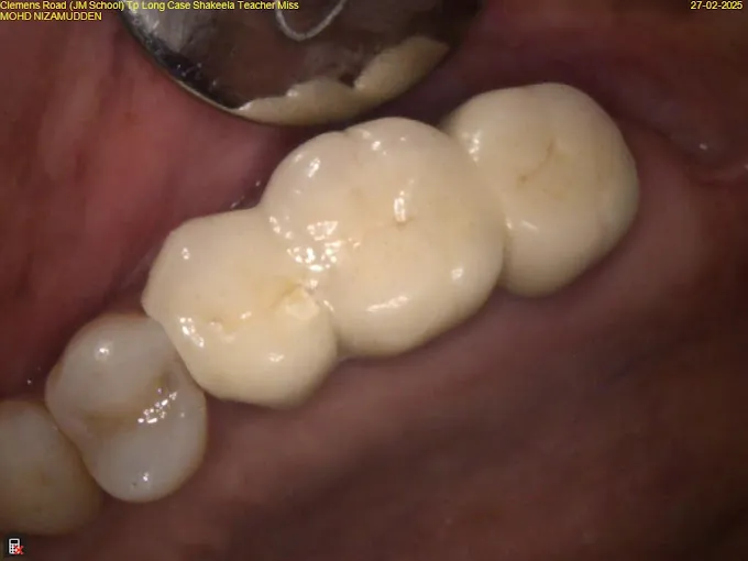 Image of: Bright Dental Care In Egmore