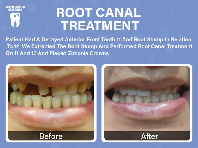 Image of: Complete Dental Care Clinic Best In Chintadripet 2
