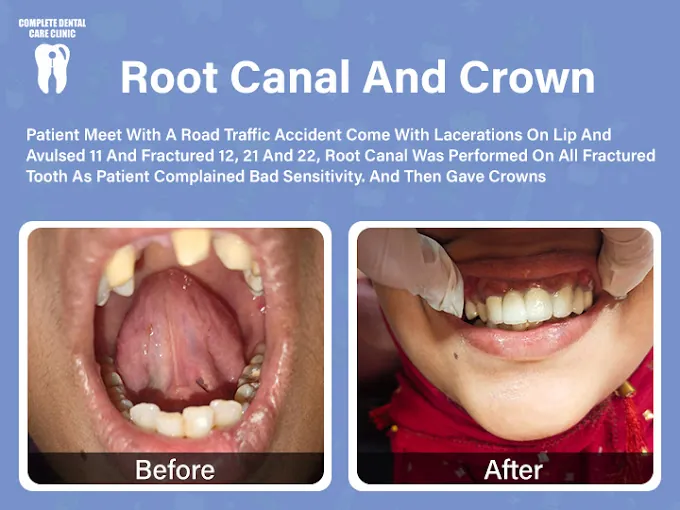 Image of: Complete Dental Care Clinic Best In Chintadripet 3