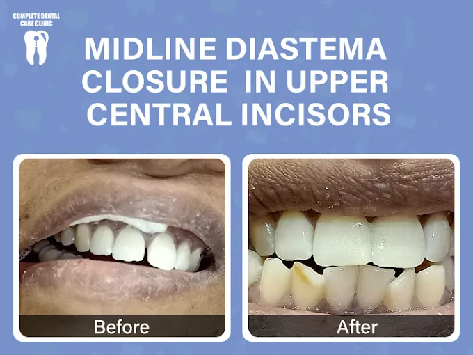 Image of: Complete Dental Care Clinic Best In Chintadripet