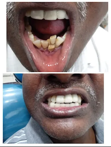 Image of: D Vel Dental Care Clinic In Tondiarpet