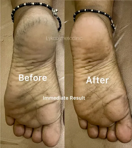 Image of: Derma Squares Cosmetic Clinic In Thiruvottiyur