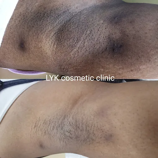 Image of: Derma Squares Cosmetic Clinic In Thiruvottiyur 2