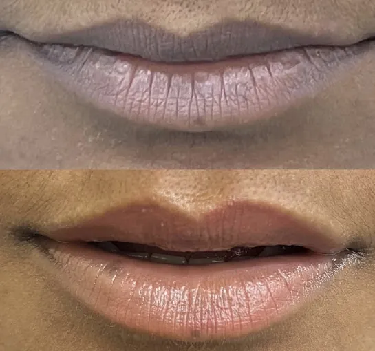 Image of: Derma Squares Cosmetic Clinic In Thiruvottiyur 3