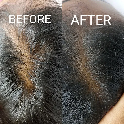 Image of: Derma Squares Cosmetic Clinic In Thiruvottiyur