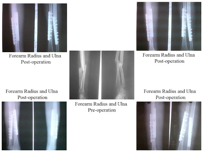 Image of: Diabetic Foot And Podiatrist In T Nagar 2