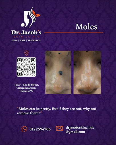 Image of: Dr Jacobs Skin Clinic In Virugambakkam