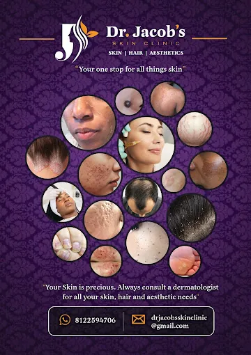 Image of: Dr Jacobs Skin Clinic In Virugambakkam 5