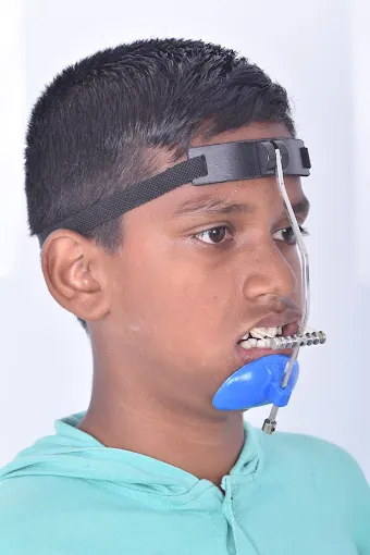 Image of: Dr Ramas Orthodontics In Kilpauk