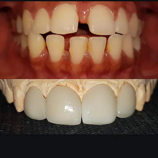 Image of: Dr Sivas Multispeciality Dental Clinic In Valasaravakkam