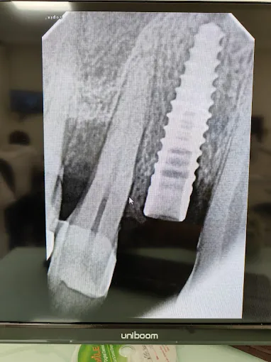 Image of: Dr Tejanis Dental Studio In Kilpauk