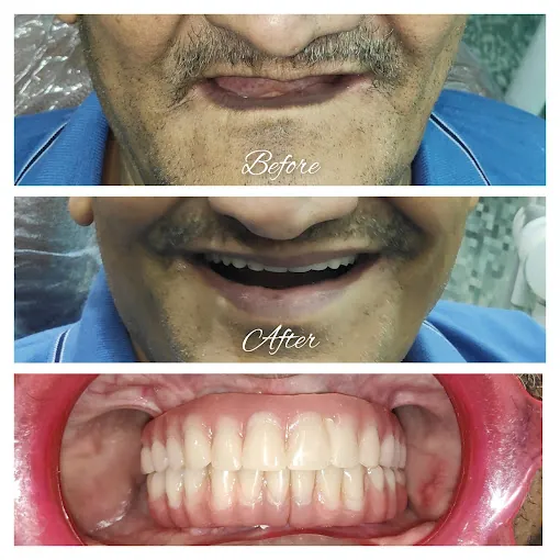 Image of: Dr Tejanis Dental Studio In Kilpauk 2