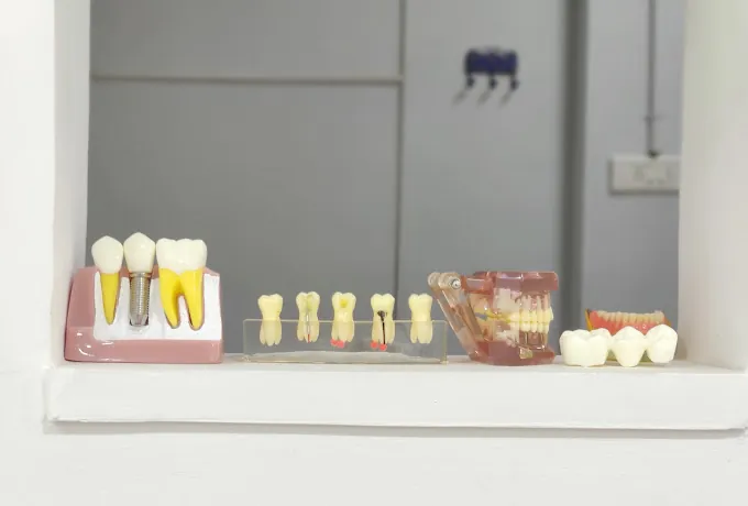 Image of: Dr Vigneshs Dentistry In Kilpauk