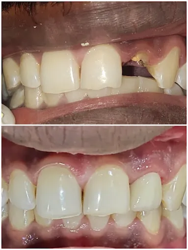 Image of: Drmonikas Dental Care In Chennai