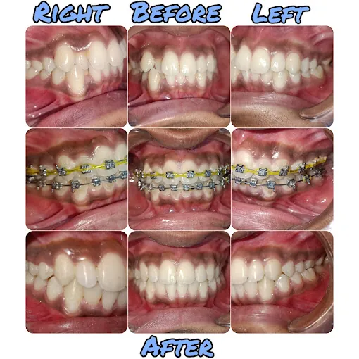 Image of: Drsowmiyas Dental Care In Perambur