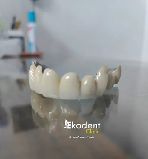 Image of: Ekodent Clinic In Egmore 3