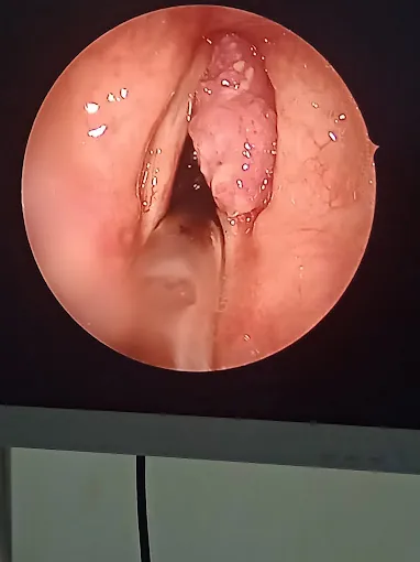 Image of: Ent Radha Clinic In T Nagar