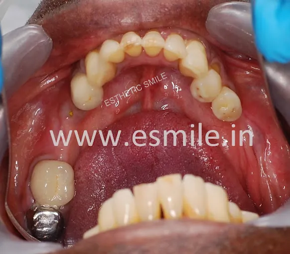 Image of: Estheticsmile Dental Clinic In Nungambakkam