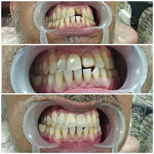 Image of: Fakhri Dental Clinic In George Town